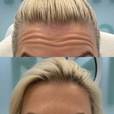 MMClinic Medycyna Estetyczna